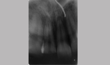 Orthodontic services in Anand                        